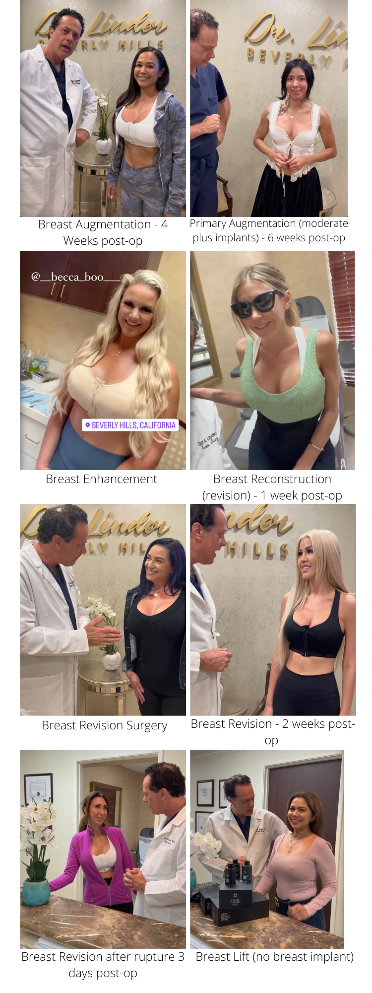 Tuberous Breast Surgery Beverly Hills